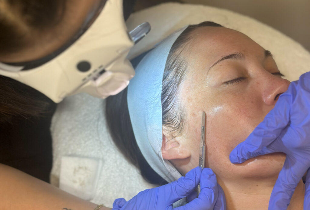 Patient getting dermaplane facial at Ascent Med Spa in Laramie, WY