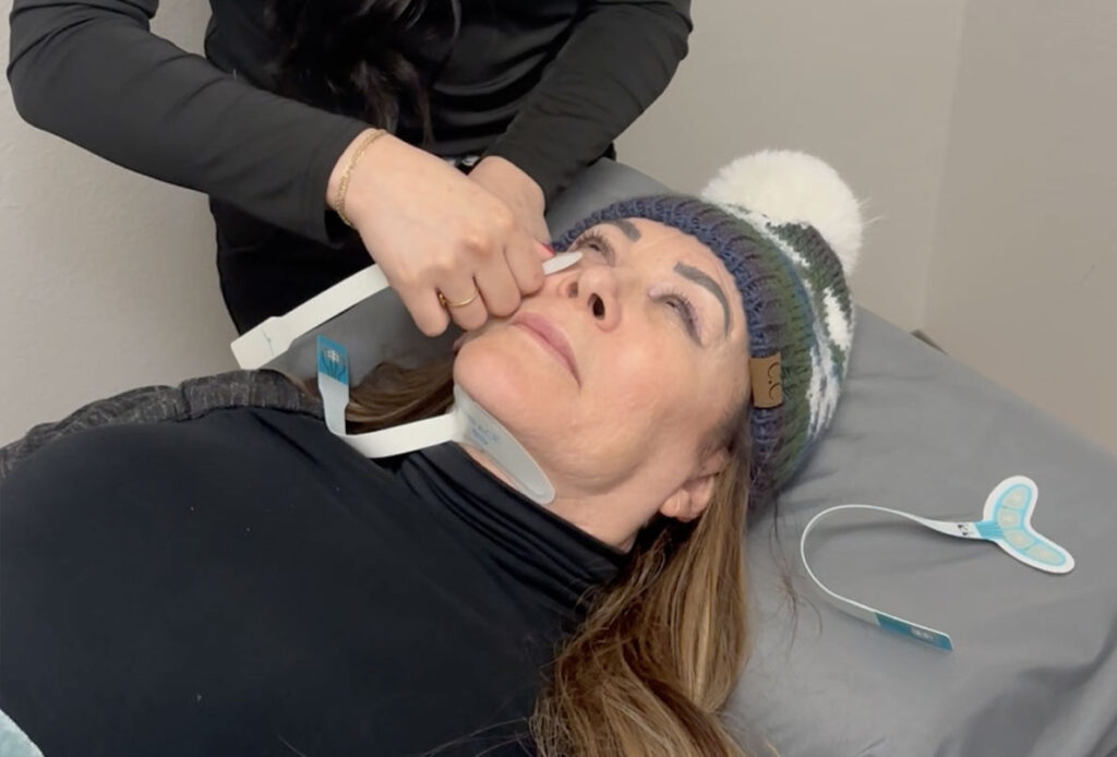 Patient receiving Emface in Laramie, WY