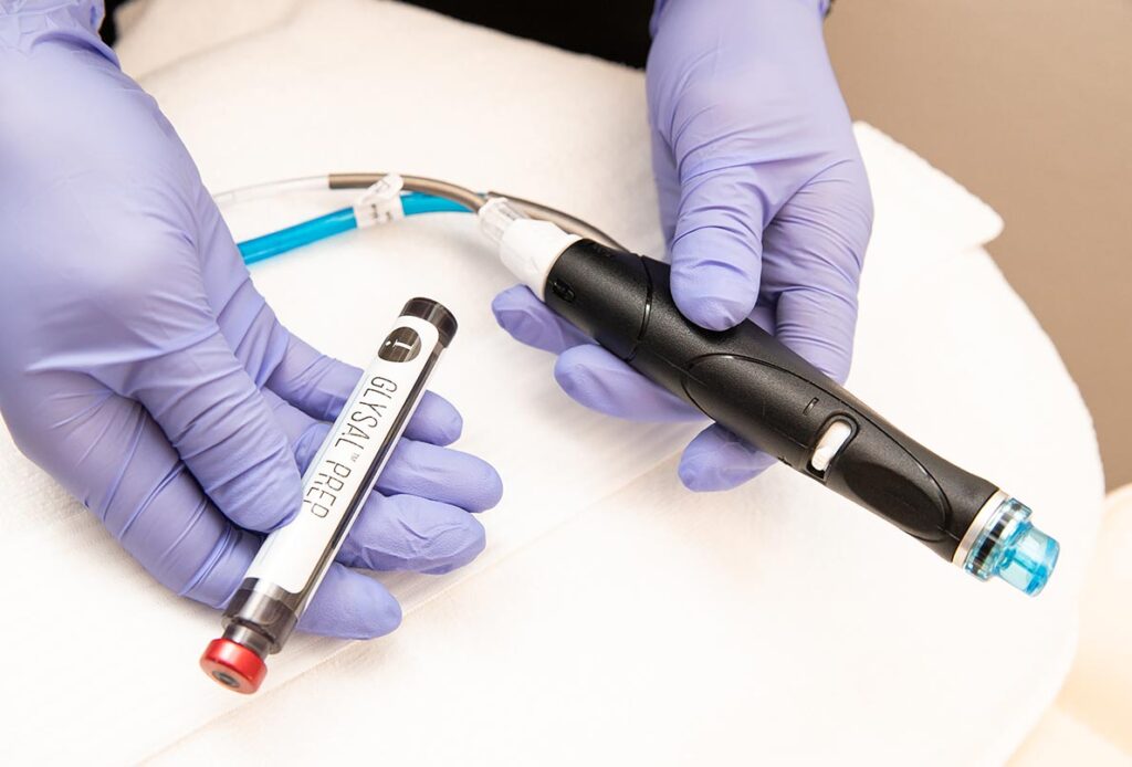 Hydrafacial tools at Ascent Med Spa in Laramie, WY
