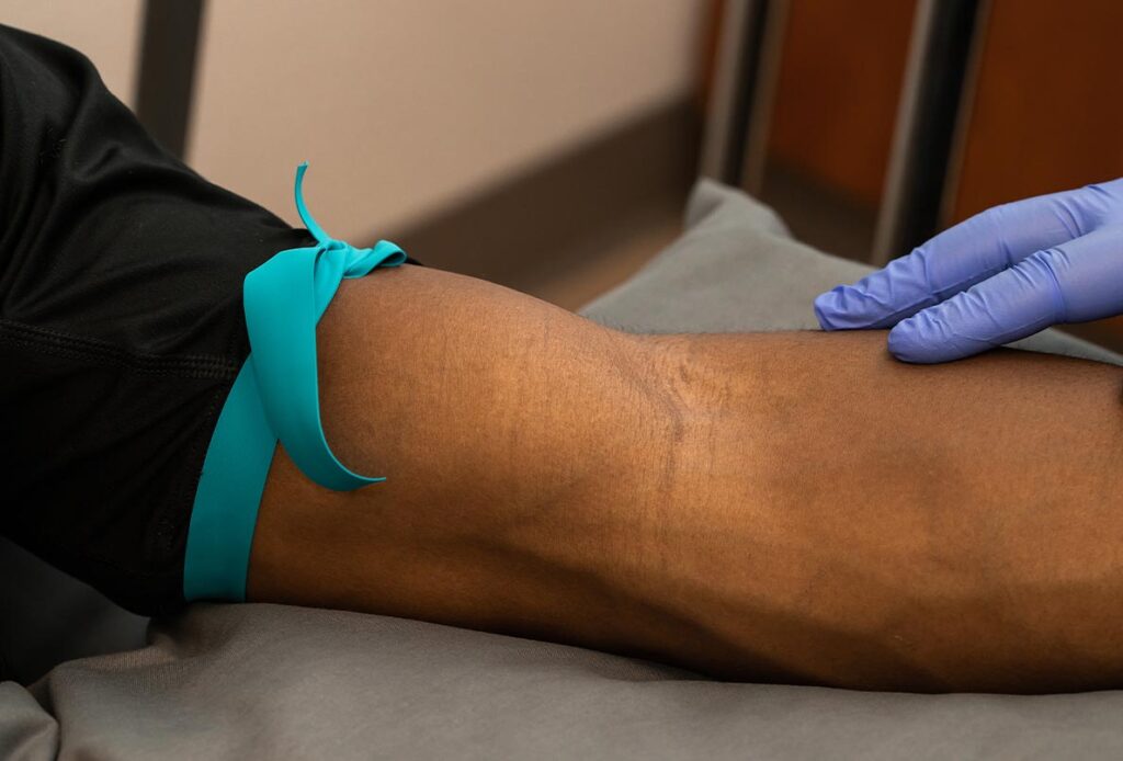 Up close of man's arm getting an IV