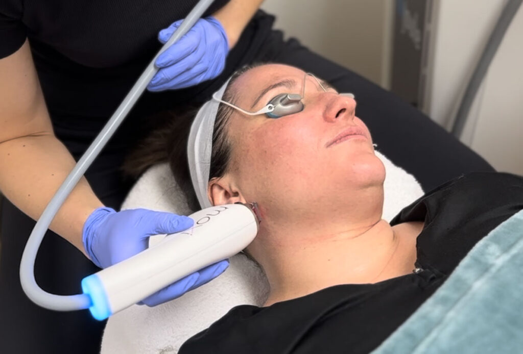 Woman receiving MOXI near her ear at Ascent Med Spa