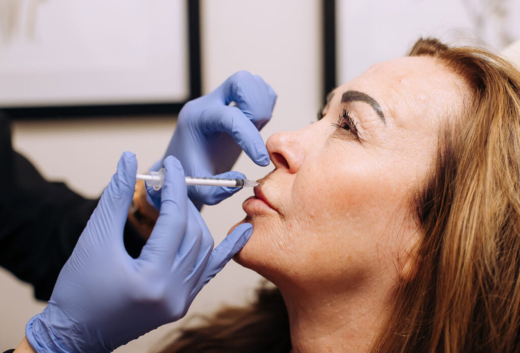 Woman receiving lip filler by Dr. Kim Westbrook in Laramie, WY