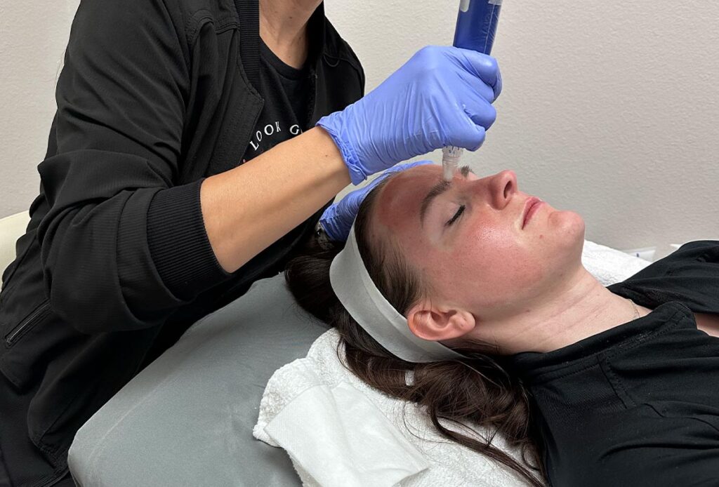 Woman receiving SkinPen microneedling at Ascent Med Spa
